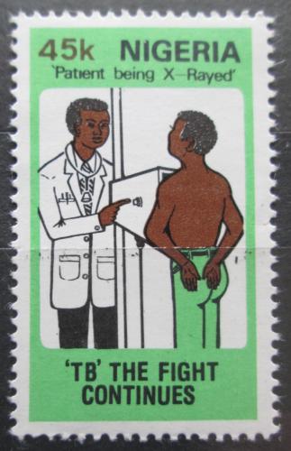 Poštová známka Nigéria 1982 Boj proti tuberkulóze Mi# 395